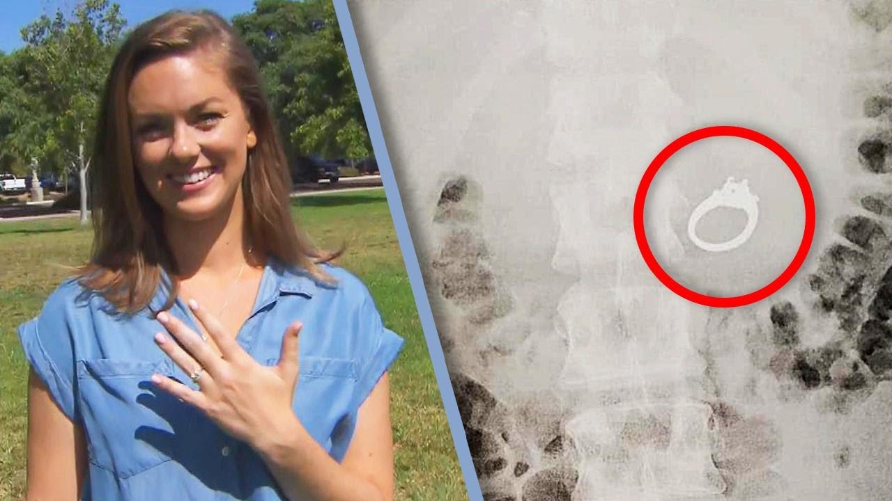 Woman Swallows Engagement Ring In Her Sleep KQ98
